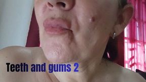 Teeth and gums 2