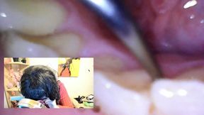 Tech-Savvy Dental Care: A Vore Day Adventure 4K