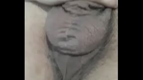 Hairy Balls