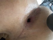 I dildo me I have dilated hole
