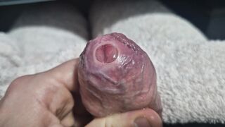 Uncircumcised Cock-squeezing Phimosis Manstick Foreskin Spread Close Up