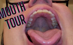 Mouth Tour with a Bottom Retainer