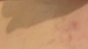 Anal Gape