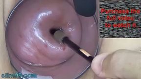 Mature Milf Cervix Play with Endoscope Japanese Cam into Uterus