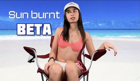 Sunburnt beta