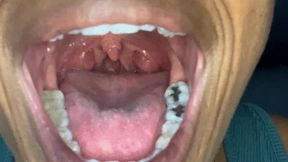 Get a good look inside my mouth