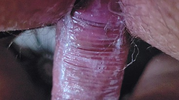 Vibrador que chupa a buceta bem gostoso
