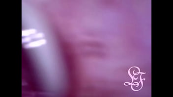 POV Endoscope Catheter Bladder Inflation!