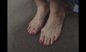 Callous Feet