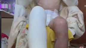 Showing off my triple cast and diaper