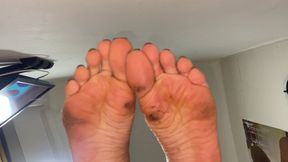 feet with street dirt