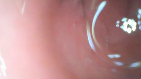 Anal endoscope