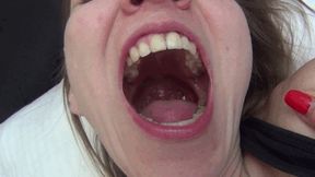 M HORRIBLE MORNING BAD BREATH 4M