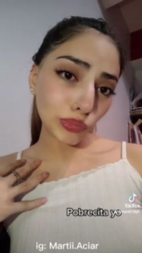 CONTEXT of My Problem in My Eye