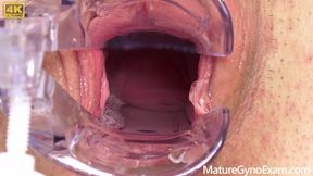 Cervix of Shy MILF Revealed!