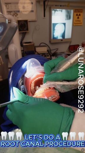LET’S DO A ROOT CANAL PROCEDURE🧤🩵🪥🦷