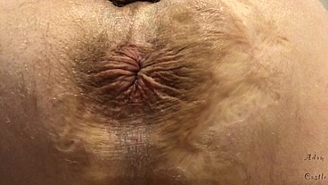 Asshole Winking 2 U Upclose Mesmerize