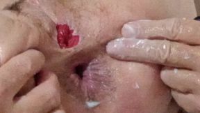 lizzy yum SD December 2025 post op shemale masturbating #56