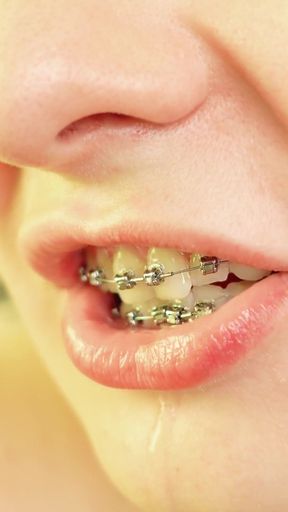 Spectacular moment from &quot;braces mouth tour video - vore fetish&quot;