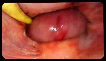 Sultry Internal Creampie Delight