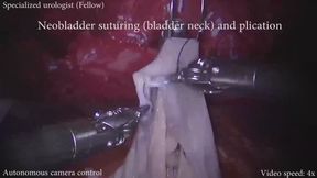 Tiny robot arms touching my guts