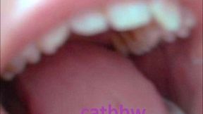 Teeth & Dental Problems - UP CLOSE chat and show - Mouth Fetish & Kink