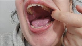 Perverted Doctor Stretches My Throat Wide – Intense Deep Throat Inspection