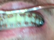 self facial on my braces and play with my cum