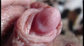 Big Clit Compilation Close-Up