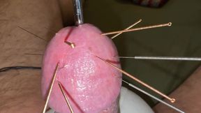 Acupuncture - Orgasm!