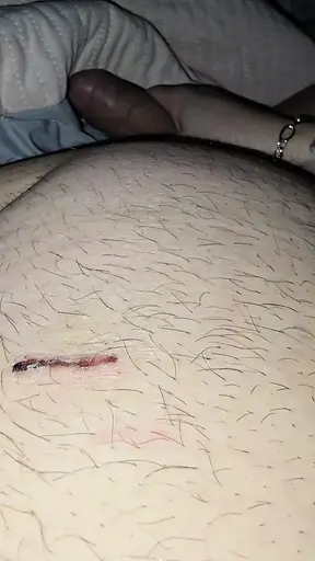 Step mom help injured step son with low erection with a handjob