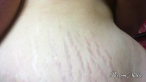 Stretchmarks of Life and Love