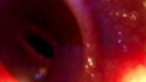 POINT OF VIEW: Slamming you in and pulling you deeper