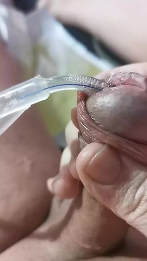 Jerking off with catheter