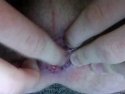 My cute little prolapsing asshole lips squeezing down and on the tip of your massive cock