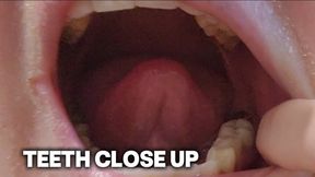Dental Fetish Close-Up – Exploring My Teeth, Opening My Mouth Wide, Showing Gums, Biting, Smiling, Tongue on Teeth