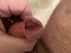Sounding the 15-16mm Hegar rod deeper