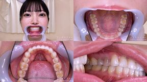 Ten Michihisa - Watching Inside mouth of Japanese cute girl - 1080p