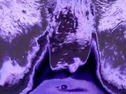 Sc Kyle Butler Purple Fame Filter 'Groovy Ball Play'