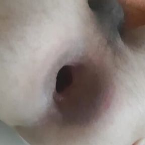 My big anal gape