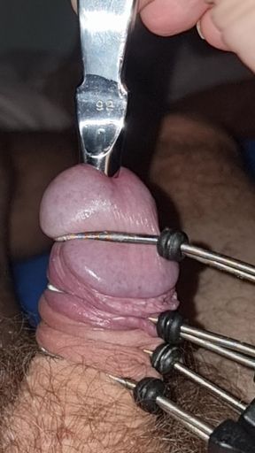 Urethral catheterization and estimation312