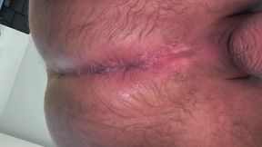 Plug anal entrant/sortant 2