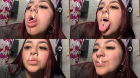 Green snot dripping + Suction