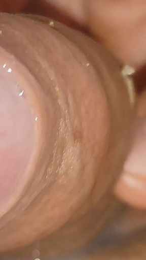 Large Cheese Accumulated in Close up of Glans