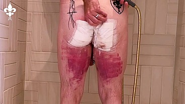 1 day after a judicial caning
