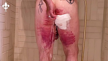 1 day after a judicial caning