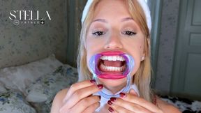 Mouth Retractor Teeth Examination