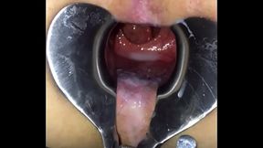 Playing with speculum 3