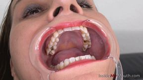 Inside My Mouth - Suzanne - Mouth retractor clip! (4K quality)