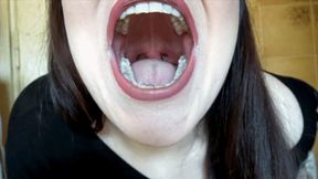 My throat, teeth, tongue and lips fully exposed